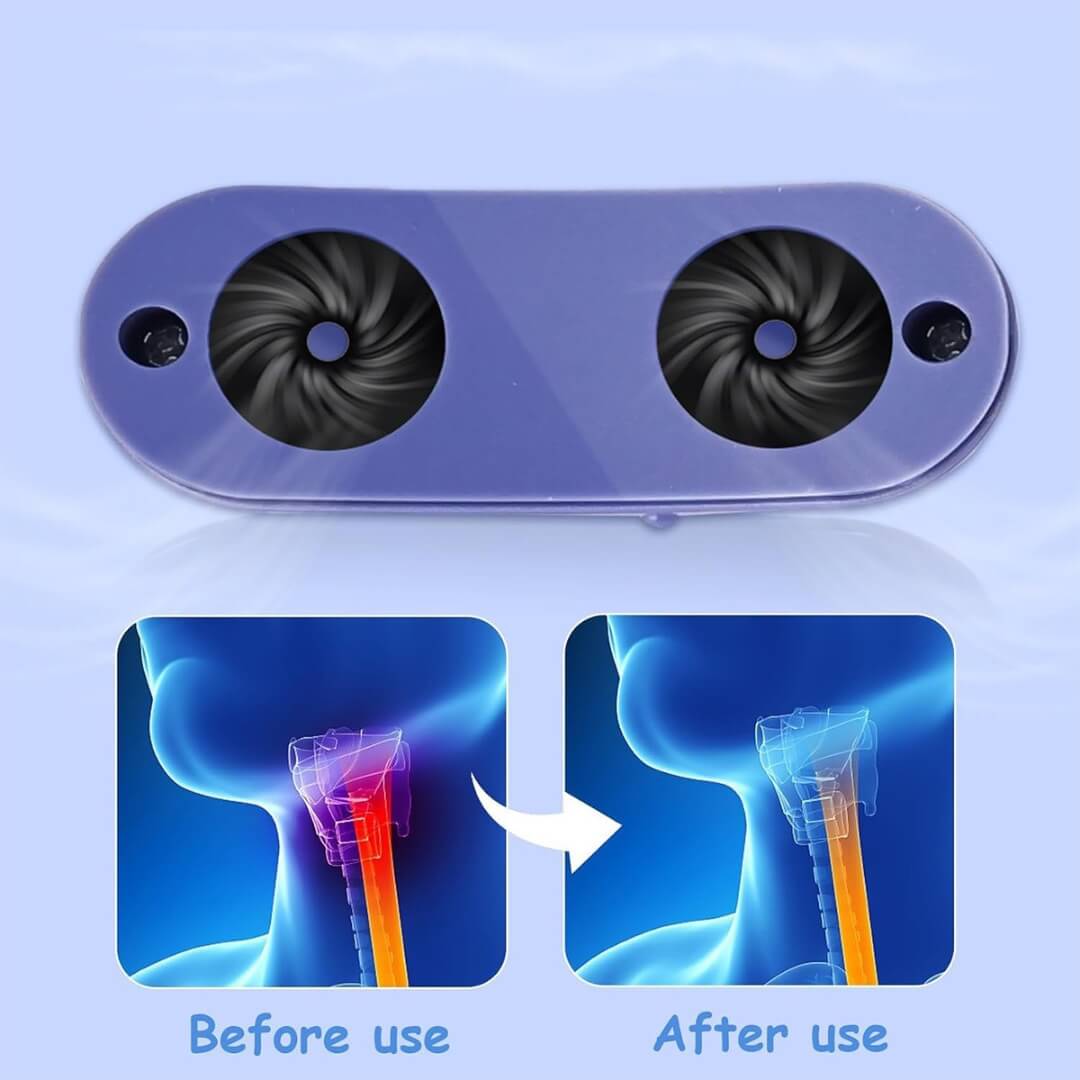 Anti-snoring device